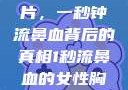 揭秘女性胸片，一秒钟流鼻血背后的真相1秒流鼻血的女性胸片视频大全