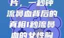 揭秘女性胸片，一秒钟流鼻血背后的真相1秒流鼻血的女性胸片视频大全