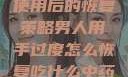 男人手部过度使用后的恢复策略男人用手过度怎么恢复吃什么中药调理