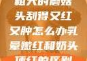 粗大的蘑菇头刮得又红又肿怎么办乳晕嫩红和奶头顶红的区别