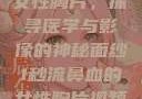 一秒流鼻血的女性胸片，探寻医学与影像的神秘面纱1秒流鼻血的女性胸片视频大全