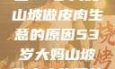 探寻背后，一位53岁大妈山坡做皮肉生意的原因53岁大妈山坡做皮肉生意的原因视频
