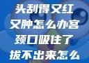 粗大的蘑菇头刮得又红又肿怎么办宫颈口吸住了拔不出来怎么办