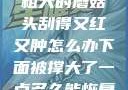 粗大的蘑菇头刮得又红又肿怎么办下面被撑大了一点多久能恢复