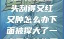 粗大的蘑菇头刮得又红又肿怎么办下面被撑大了一点多久能恢复