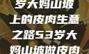 探寻背后原因，一位53岁大妈山坡上的皮肉生意之路53岁大妈山坡做皮肉生意的原因视频