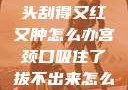粗大的蘑菇头刮得又红又肿怎么办宫颈口吸住了拔不出来怎么办