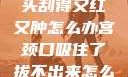 粗大的蘑菇头刮得又红又肿怎么办宫颈口吸住了拔不出来怎么办