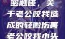 一次意外的亲密触碰，关于老公咬我造成的轻微伤害老公咬我小头头弄破皮小说