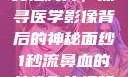 一秒流鼻血的女性胸片，探寻医学影像背后的神秘面纱1秒流鼻血的女性胸片视频大全