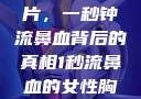 揭秘女性胸片，一秒钟流鼻血背后的真相1秒流鼻血的女性胸片视频大全