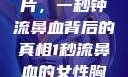 揭秘女性胸片，一秒钟流鼻血背后的真相1秒流鼻血的女性胸片视频大全
