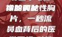 一秒流鼻血的女性胸片，探寻医学与影像的奥秘
神秘的女性胸片，一秒流鼻血背后的医学真相1秒流鼻血的女性胸片视频大全