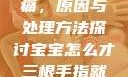 宝宝三根手指痛，原因与处理方法探讨宝宝怎么才三根手指就痛黄