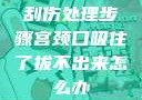 刮伤处理步骤宫颈口吸住了拔不出来怎么办
