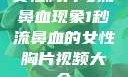 女性胸片与流鼻血现象1秒流鼻血的女性胸片视频大全