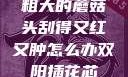 粗大的蘑菇头刮得又红又肿怎么办双阳插花芯