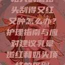 粗大的蘑菇头刮得又红又肿怎么办？护理指南与应对建议乳晕嫩红和奶头顶红的区别  第1张