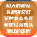 粗大的蘑菇头刮得又红又肿怎么办乳晕嫩红和奶头顶红的区别  第1张