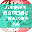刮伤处理步骤宫颈口吸住了拔不出来怎么办  第1张