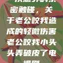 一次意外的亲密触碰，关于老公咬我造成的轻微伤害老公咬我小头头弄破皮了电视剧  第1张