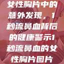 女性胸片中的意外发现，1秒流鼻血背后的健康警示1秒流鼻血的女性胸片图片  第1张