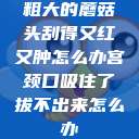 粗大的蘑菇头刮得又红又肿怎么办宫颈口吸住了拔不出来怎么办  第1张