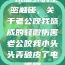 一次意外的亲密触碰，关于老公咬我造成的轻微伤害老公咬我小头头弄破皮了电视剧  第1张