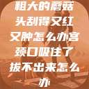 粗大的蘑菇头刮得又红又肿怎么办宫颈口吸住了拔不出来怎么办 第1张 粗大的蘑菇头刮得又红又肿怎么办宫颈口吸住了拔不出来怎么办 第1张