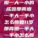 理解现象，两瓣一大一小的成因那两瓣一半大一半小怎么恢复11岁那两瓣一半大一半小怎么恢复  第1张