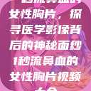 一秒流鼻血的女性胸片，探寻医学影像背后的神秘面纱1秒流鼻血的女性胸片视频大全  第1张