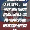 一秒流鼻血的女性胸片,探寻医学影像背后的神秘与真相1秒流鼻血的女性胸片图片 第1张 一秒流鼻血的女性胸片,探寻医学影像背后的神秘与真相1秒流鼻血的女性胸片图片 第1张